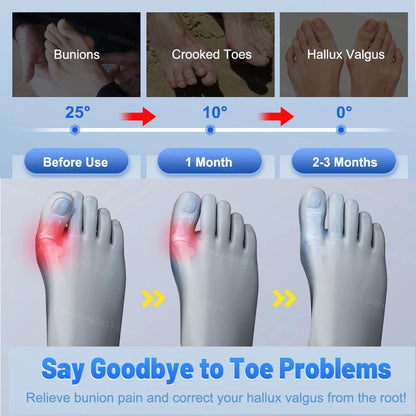 ToeRelief Pro