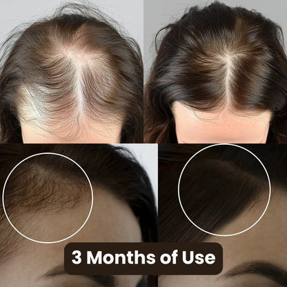 Botana Roots - Hair Oil